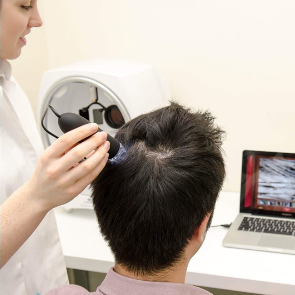 Thinning Hair - Bioscor International