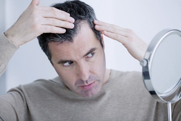 Hair Loss Bioscor International