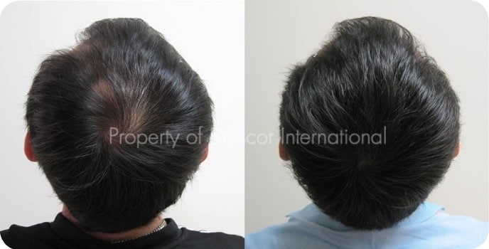 Hair Growth Treat Hair Growth Treat