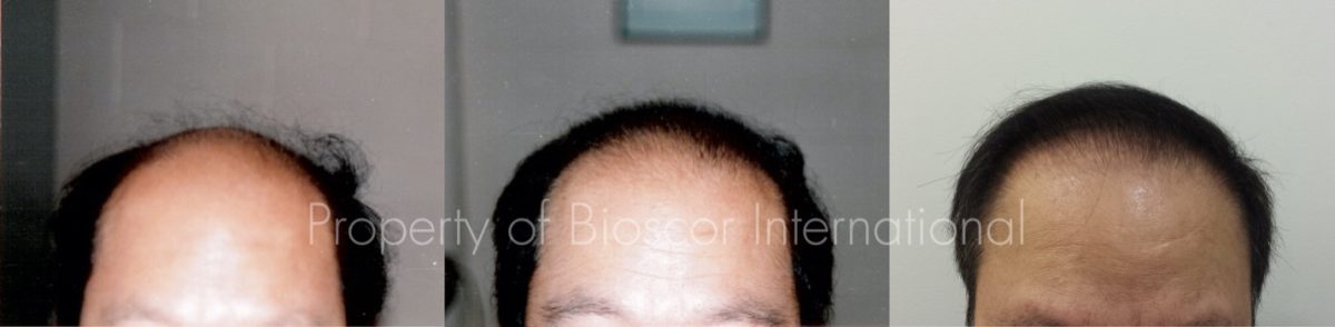Haircare Products - Bioscor International