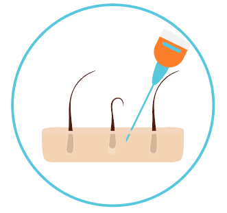 prp-inject prp inject