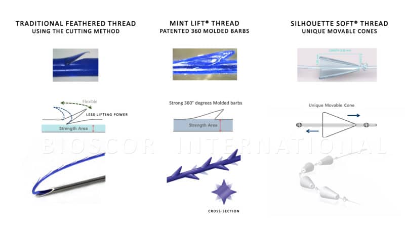 Collagen-Stimulating Thread Lifts Treatment - Bioscor International