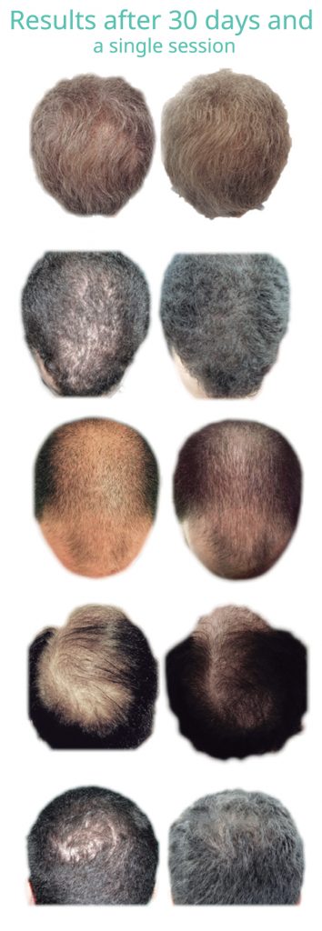 regenera-testimonıals single session result - Bioscor International