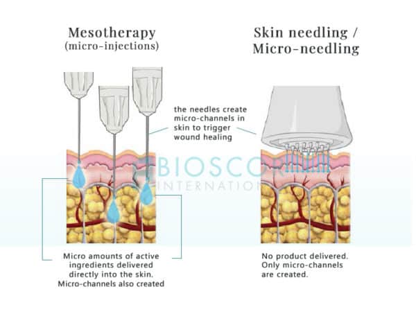 mesotherapy vs skin needling differences bioscor skin clinic cosmetic treatments micro injections microneedlings australia Mesotherapy Injections with Micro-needling - Bioscor International