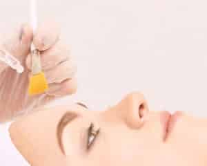 Chemical Peel - Bioscor International