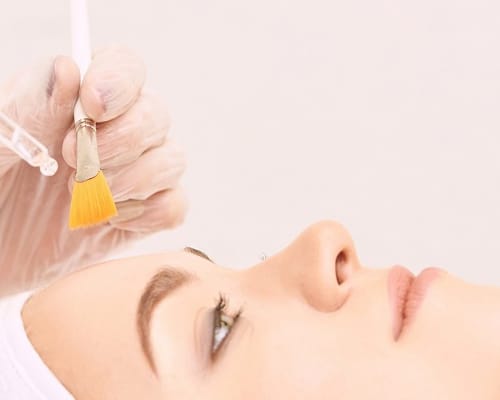 Chemical Peels Treatment | Bioscor International