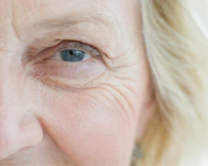 ageing skin