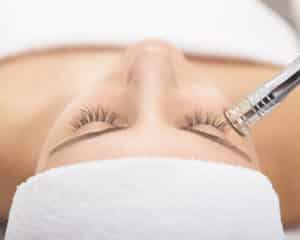 Microdermabrasion - Bioscor International