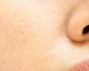 Pores - Bioscor International