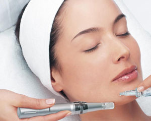 SkinPen