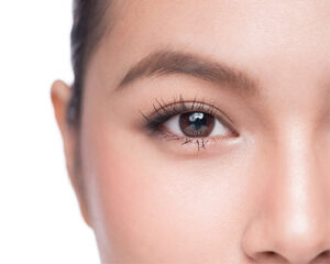 double eyelid Double Eyelid Cosmetic Procedure Before and After - Bioscor International