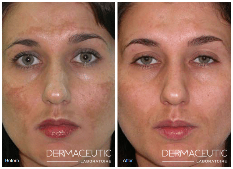bioscor dermaceutic