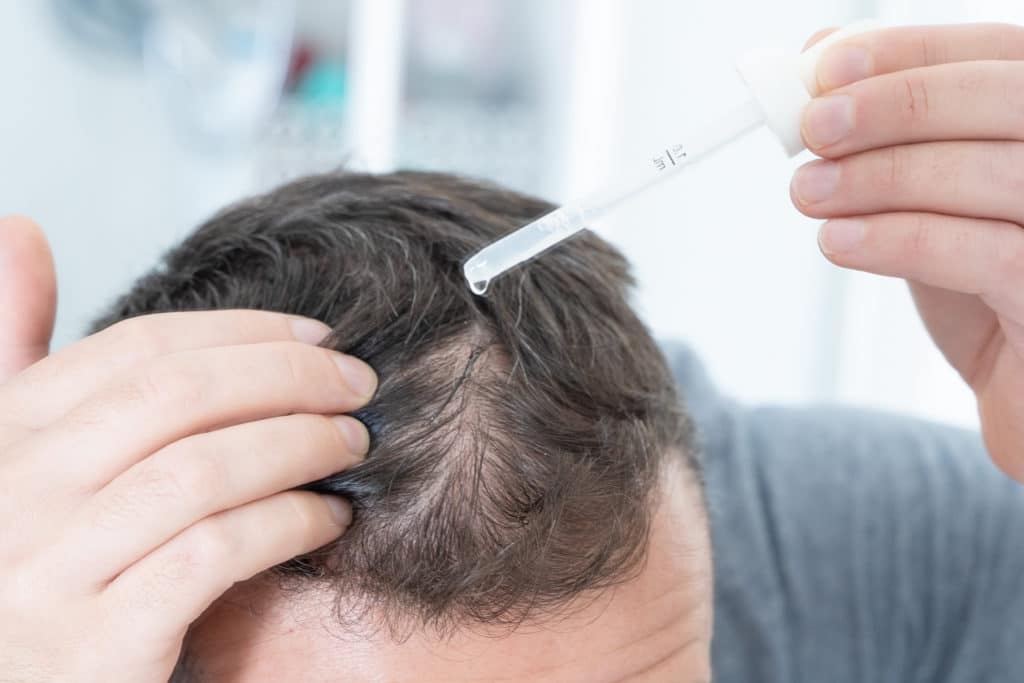 hair loss treatment