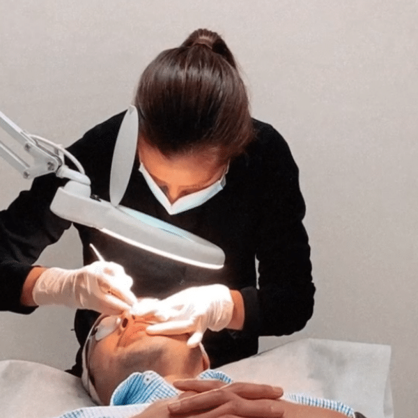 Acne Treatment Melbourne