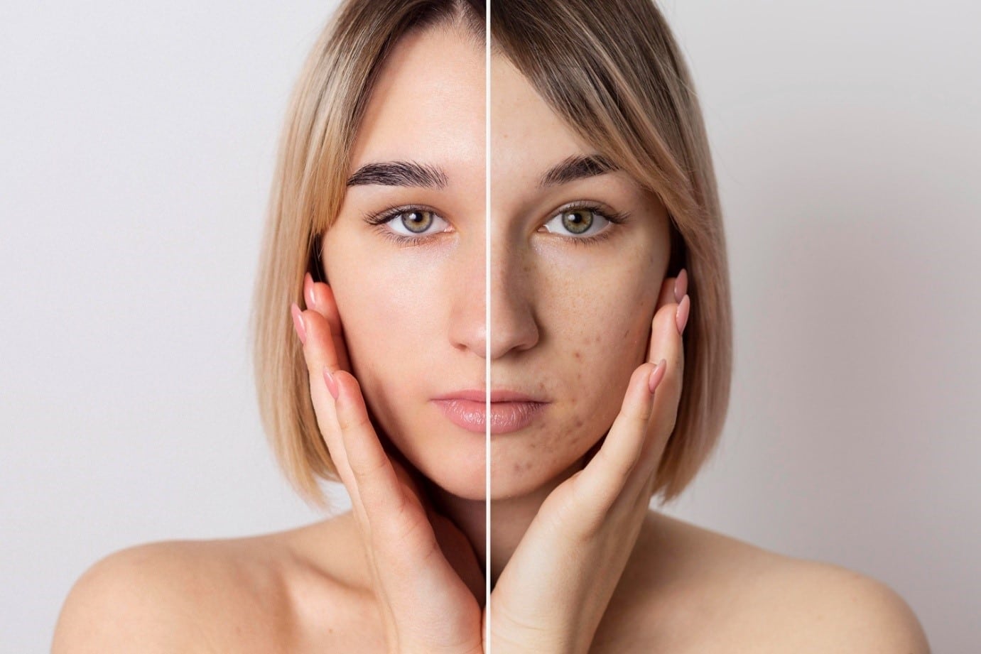 Skin Pigmentation Treatment