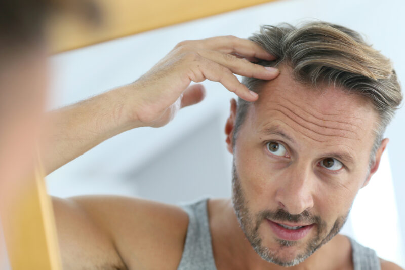 dreamstime_l_60823263 Hair loss treatment