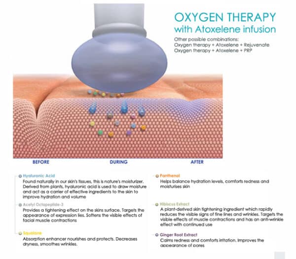 Intraceuticals Oxygen Therapy | Bioscor International