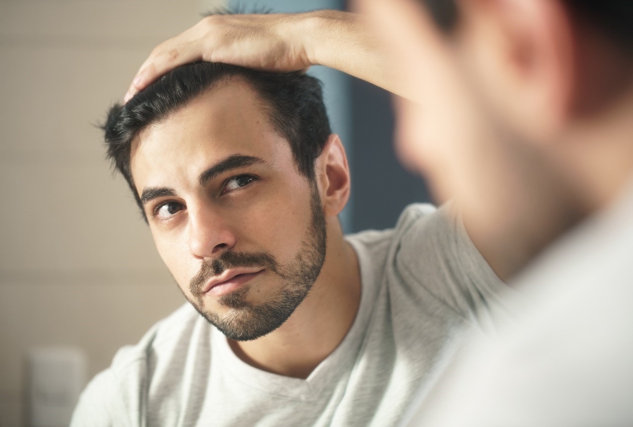 Male Hair Loss