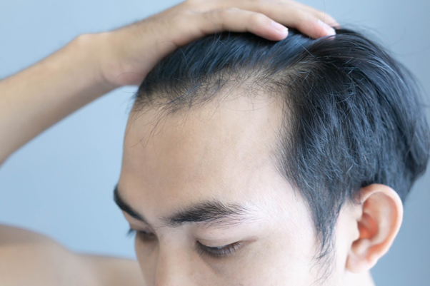 hair loss treatments hair loss treatments