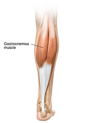 calf slimming