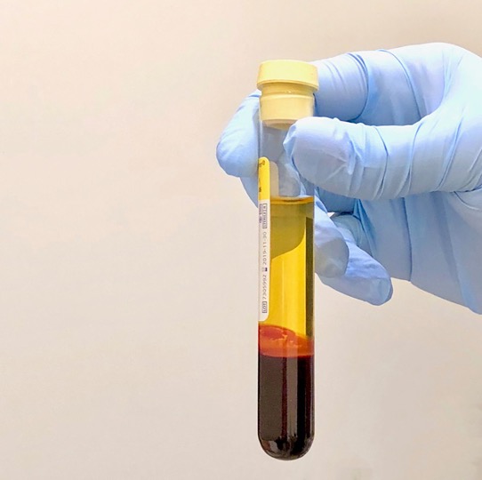 blood tube-prf blood tube prf