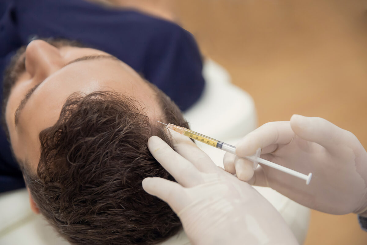 Hair Loss Treatment For Men - Bioscor International