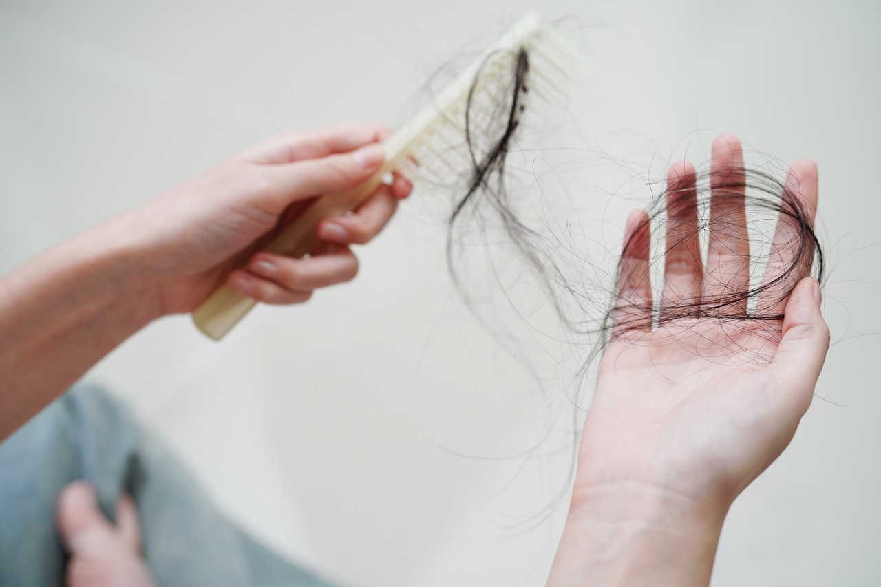 hair loss clinics in Melbourne hair loss clinics in Melbourne
