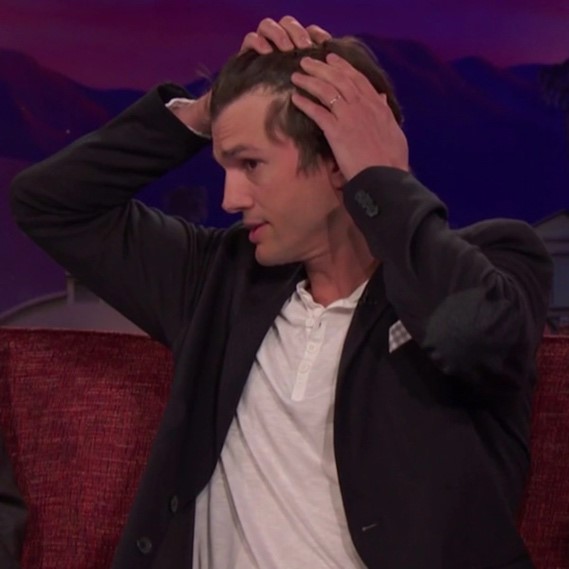 ashton-kutcher Hair Loss Treatment For Men - Bioscor International