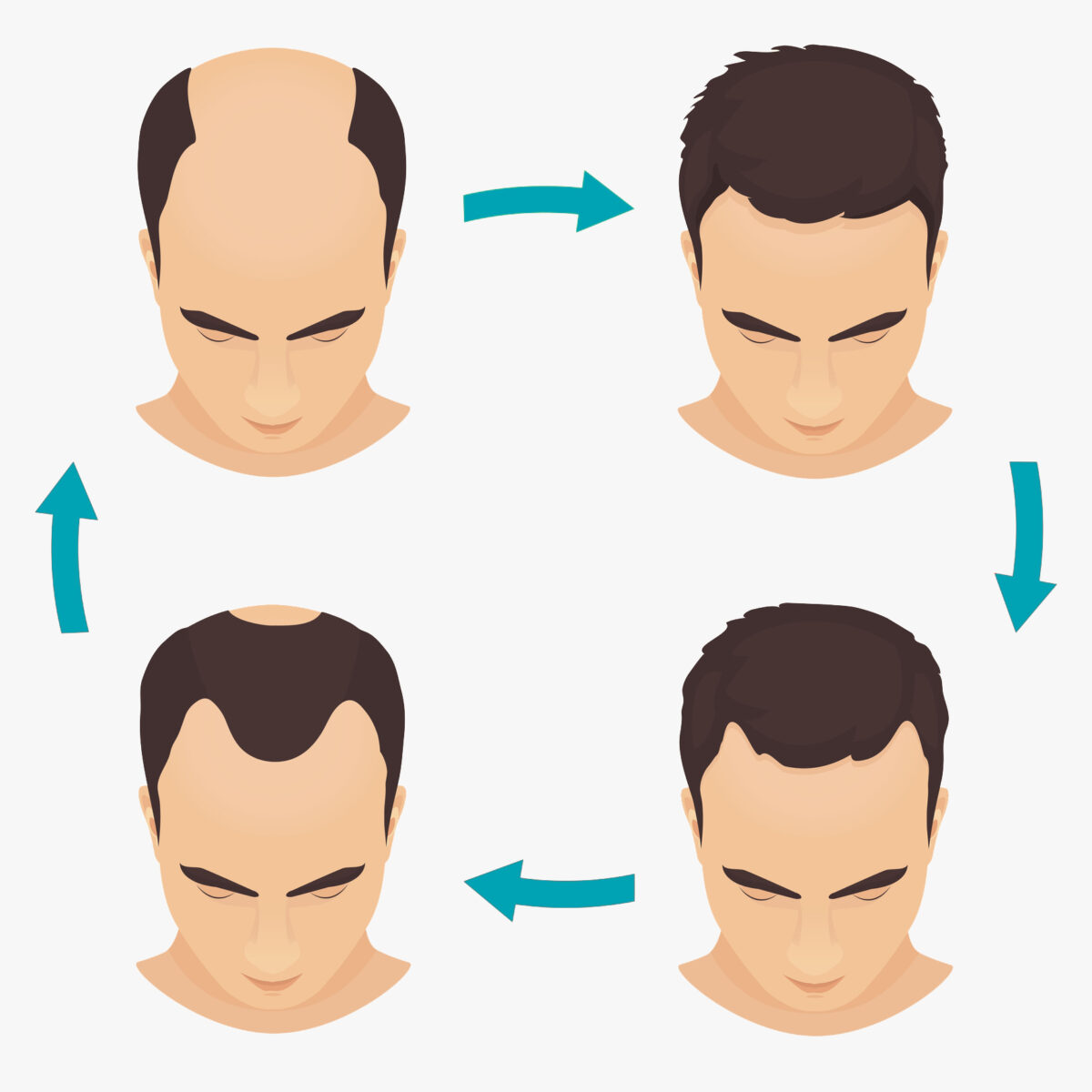 Male pattern baldness set